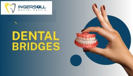 Dental Bridges services